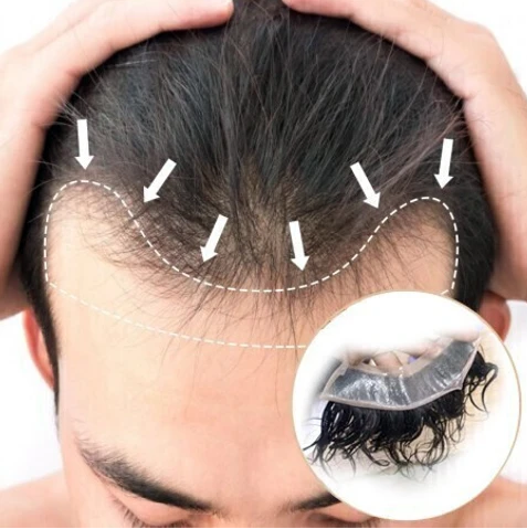 Customized Hair Patch